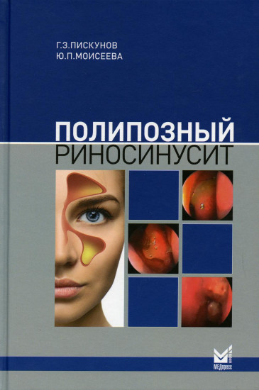 Полипозный риносинусит