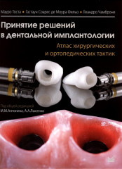 Принятие решений в дентальной имплантологии