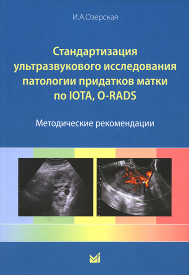 Стандартизация ультразвукового исследования патологии придатков матки по IOTA, O-RADS. Методические рекомендации