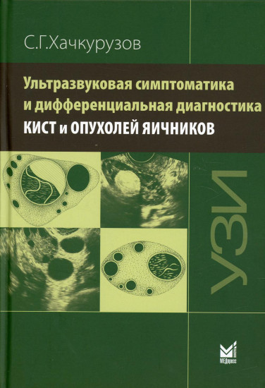 Ультразвуковая симптоматика