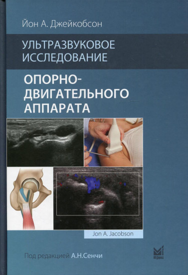 Ультразвуковое исследование