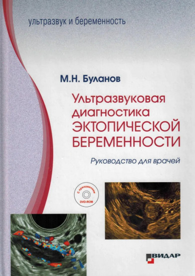 Ультразвуковая диагностика эктопической беременности. Руководство для врачей с приложением DVD-ROM