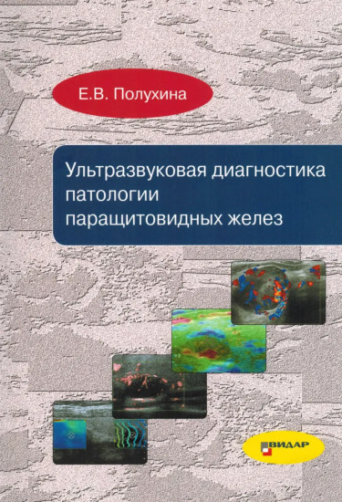 Ультразвуковая диагностика