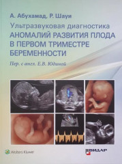 Ультразвуковая диагностика