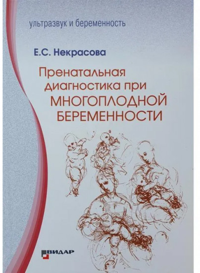 Пренатальная диагностика