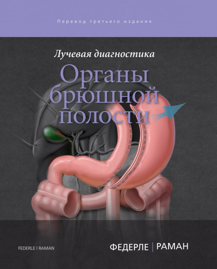 Лучевая диагностика. Органы брюшной полости
