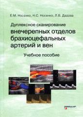 Дуплексное сканирование внечерепных отделов