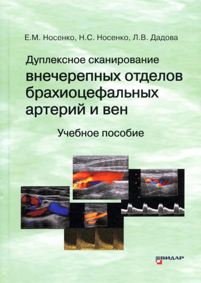 Дуплексное сканирование внечерепных отделов