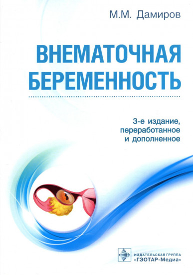 Внематочная беременность