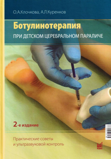 Ботулинотерапия при ДЦП