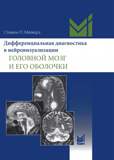 Дифференциальная диагностика
