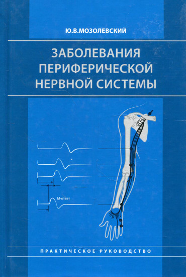 Заболевания периферической нервной системы