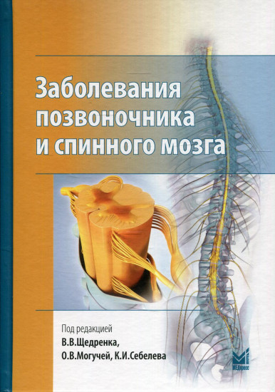 Заболевания позвоночника и спинного мозга