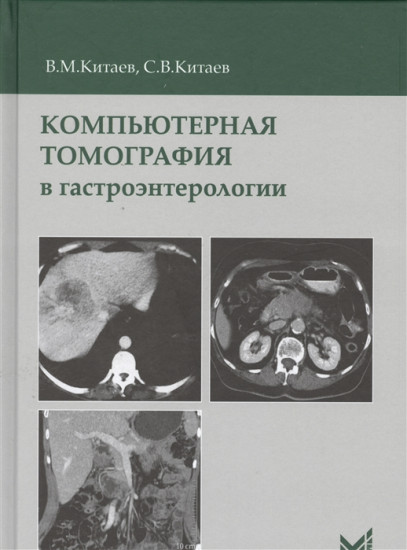 Компьютерная томография в гастроэнтерологии. Руководство для врачей