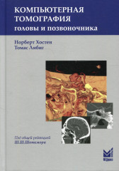 Компьютерная томография головы и позвоночника