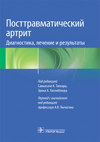 Посттравматический артрит
