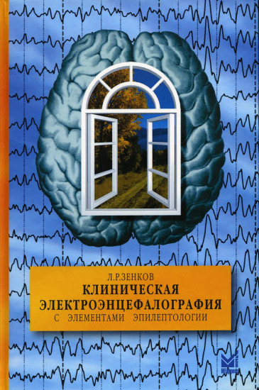Клиническая электроэнцефалография