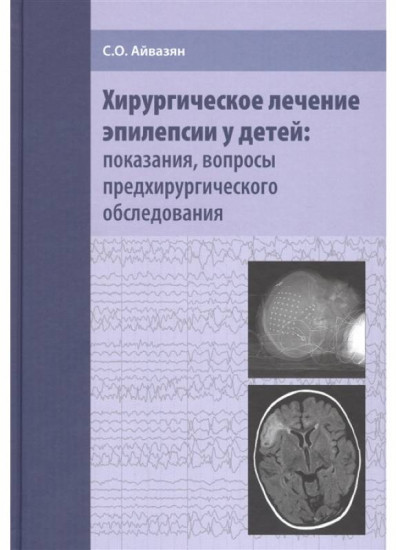 Хирургическое лечение эпилепсии у детей