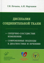 Дисплазия соединительной ткани