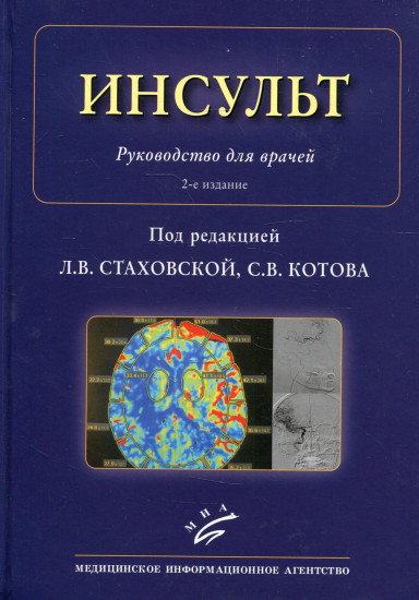 Инсульт