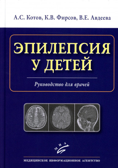 Эпилепсия у детей