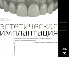 Эстетическая имплантация