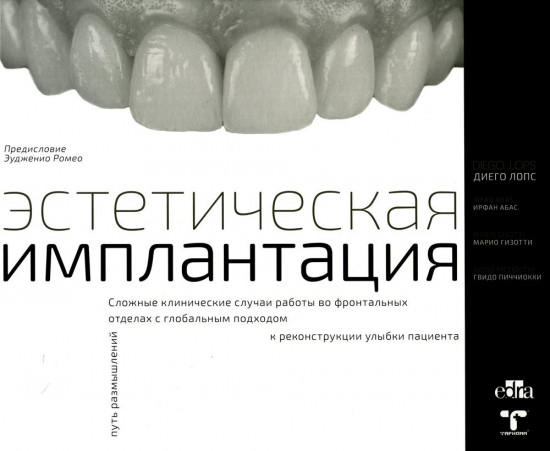 Эстетическая имплантация. Сложные клинические случаи работы во фронтальных отделах с глобальным подходом к реконструкции улыбки пациента