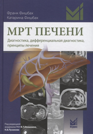 МРТ печени. Диагностика
