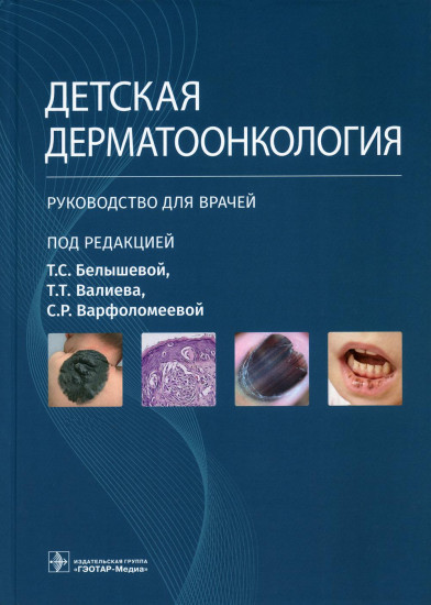 Детская дерматоонкология