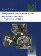 Дифференциальная диагностика в нейровизуализации