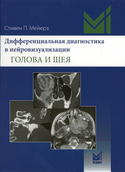 Дифференциальная диагностика в нейровизуализации