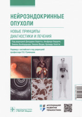 Нейроэндокринные опухоли