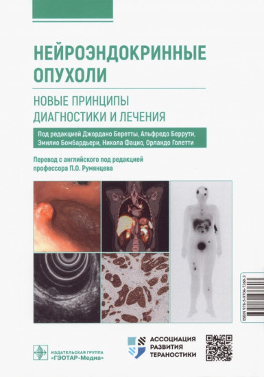 Нейроэндокринные опухоли