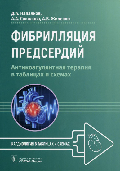 Фибрилляция предсердий