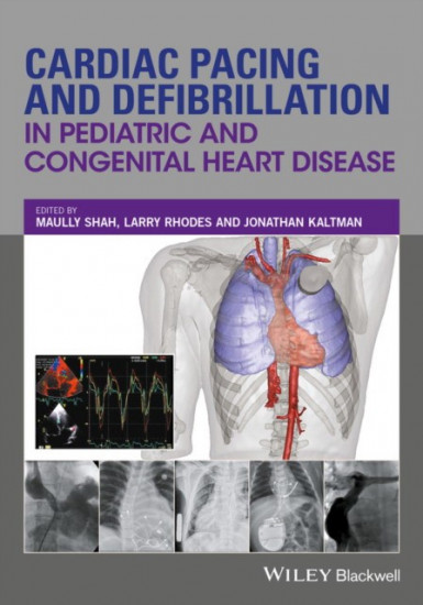 Cardiac Pacing and Defibrillation