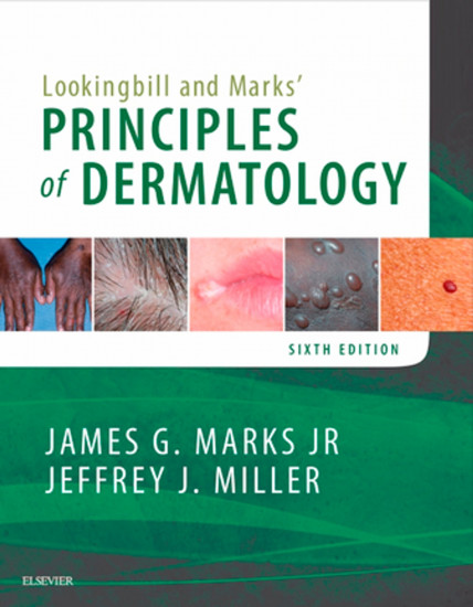 Lookingbill and Marks` Principles of Dermatology