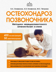 Остеохондроз позвоночника