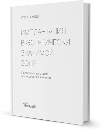 Имплантация в эстетически значимой зоне