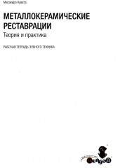 Металлокерамические реставрации