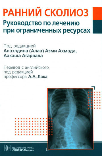 Ранний сколиоз. Руководство по лечению при ограниченных ресурсах