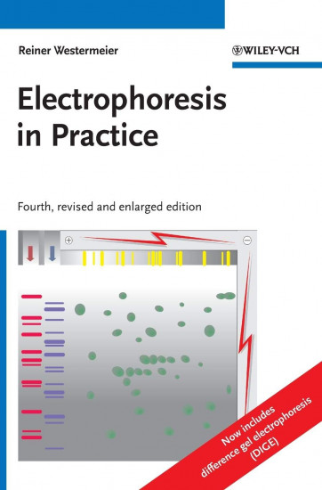 Electrophoresis in Practice