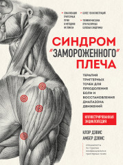 Синдром «замороженного» плеча