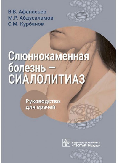 Слюннокаменная болезнь. Сиалолитиаз