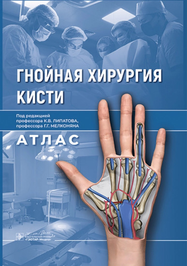 Гнойная хирургия кисти