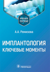 Имплантология: ключевые моменты