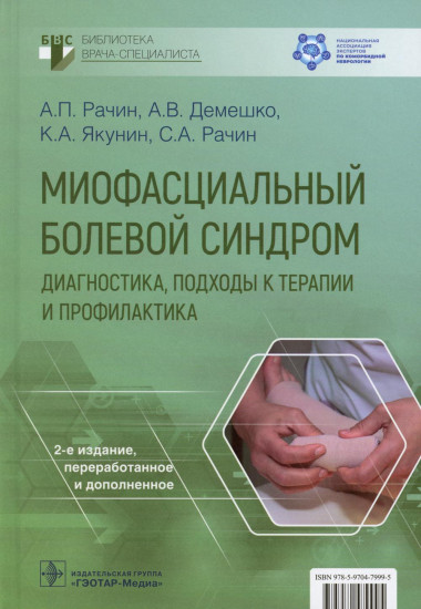 Миофасциальный болевой синдром