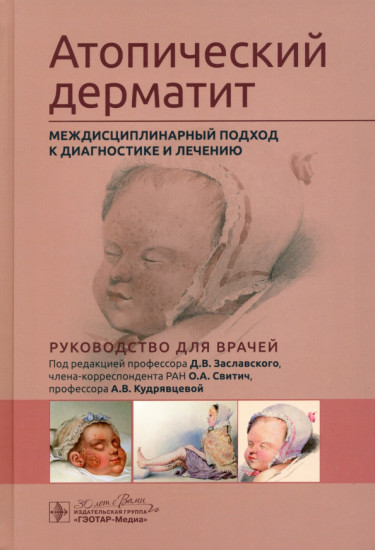Атопический дерматит
