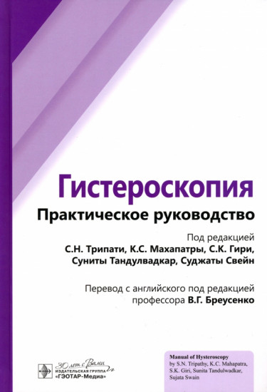 Гистероскопия: практическое руководство