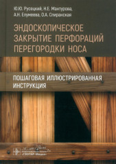 Эндоскопическое закрытие перфораций перегородки носа