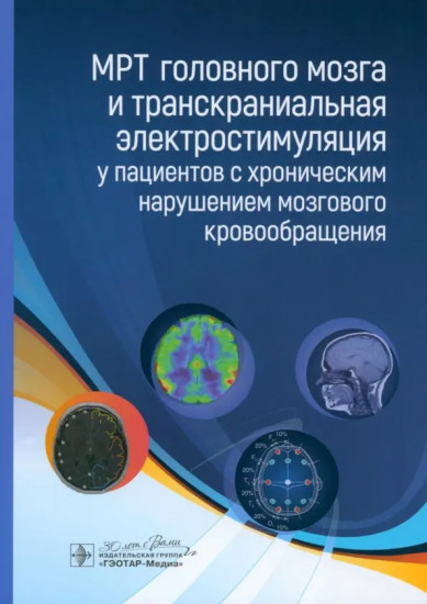 МРТ головного мозга
